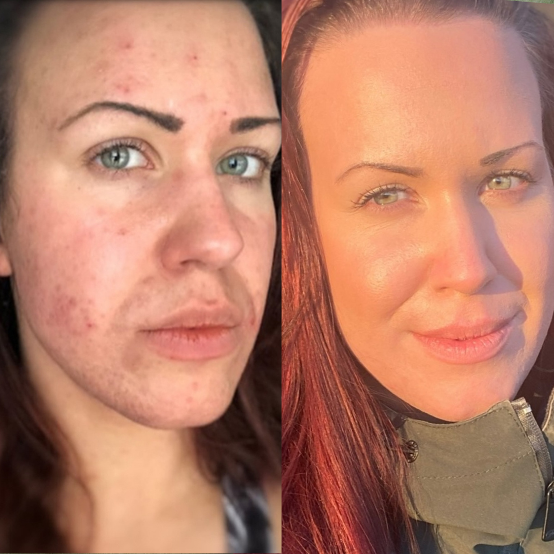 Hyaluronic Moisture+ Mist